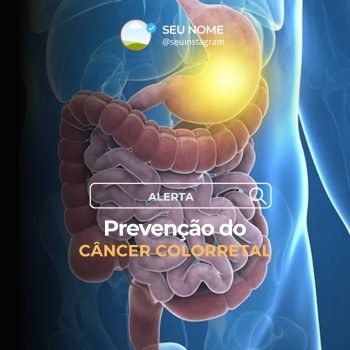 instagram magnético 010
