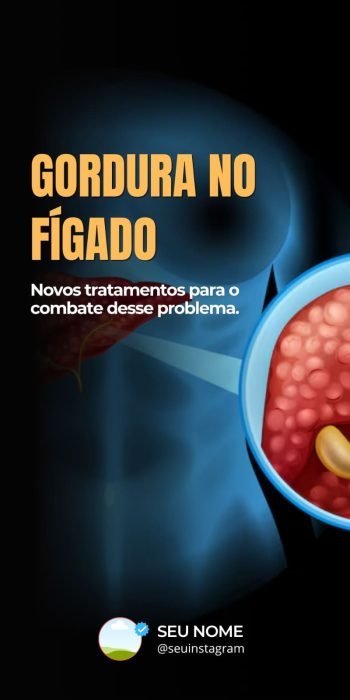 instagram magnético 037